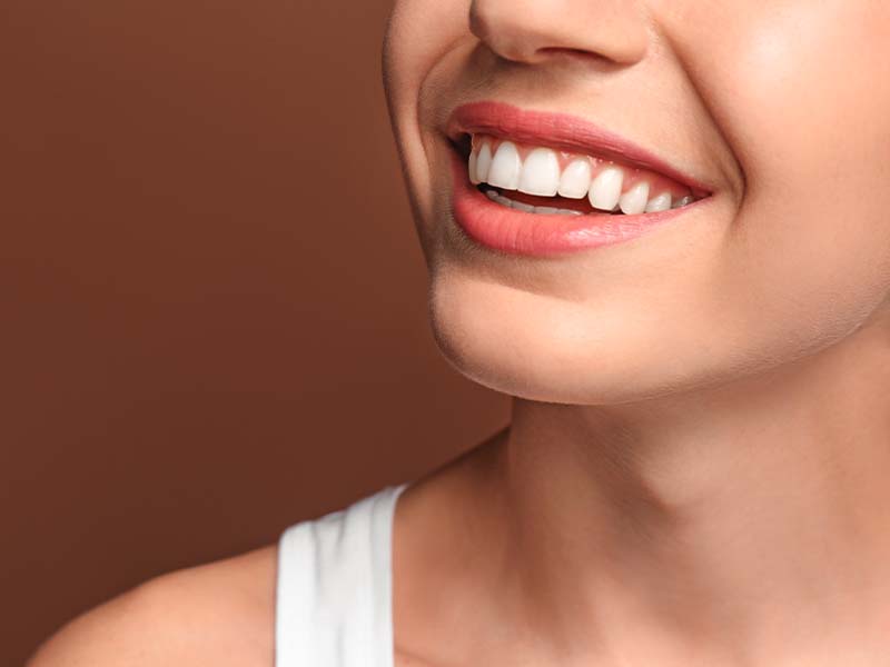 Patient smiling during clear aligner treatment