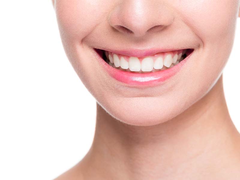 How clear aligners gradually straighten teeth