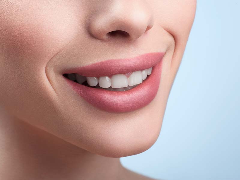 Tooth-coloured composite bonding for cosmetic repairs