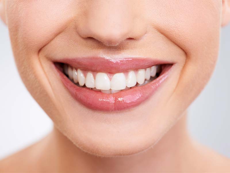 Healthy adult smile and dental implant restoration planning at Cornwall Dental Arts