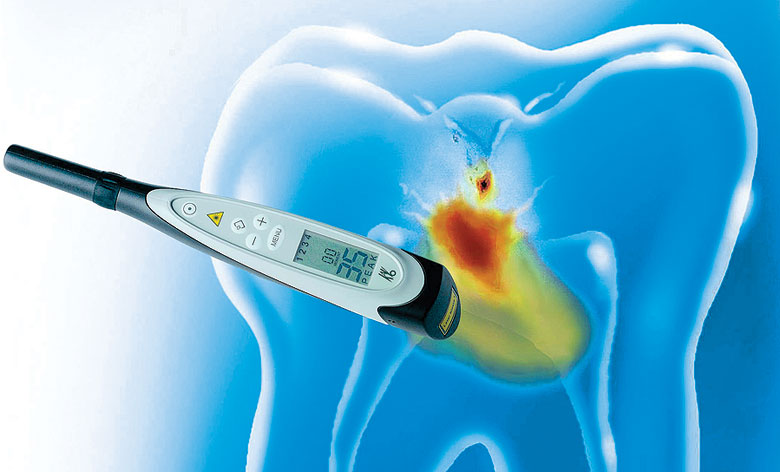 Dental diagnostic technology at Cornwall Dental Arts
