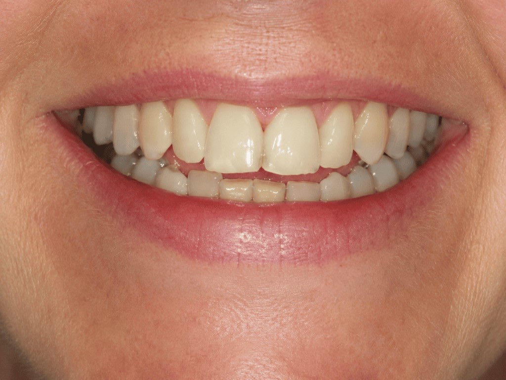 Cosmetic dentistry transformation — before