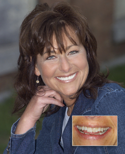 Cosmetic Dentistry in Cornwall